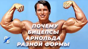 Почему бицепсы Арнольда Шварценеггера разной формы