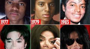 Как выглядело бы сейчас настоящее лицо Майкла Джексона