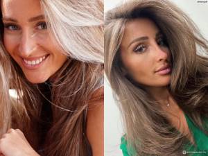 Ринопластика без операции