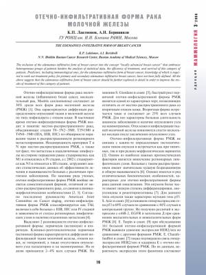 Отечно-инфильтративная форма рака молочной железы