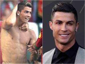 Какие футболисты делали себе пластику? Роналду, Марадона, Ибрагимович