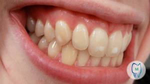 Советы специалиста