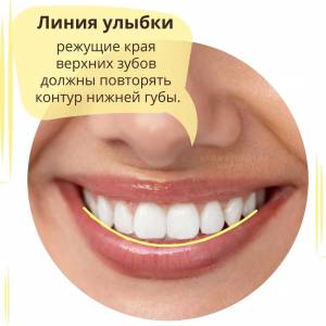 Формула идеальной улыбки