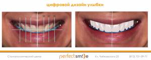 3 шага до красивой улыбки