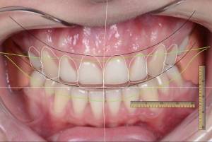 Анализ лица и улыбки