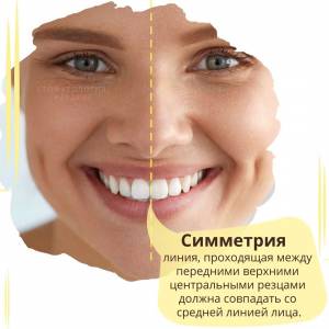 Формула идеальной улыбки