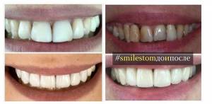 Идеальные зубы в 2021