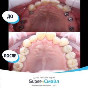 Идеальные зубы в 2021