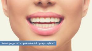 Прикус зубов правильный и неправильный