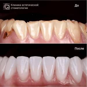 Идеальная форма зубов