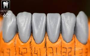 Простая инструкция по моделированию зубов из воска