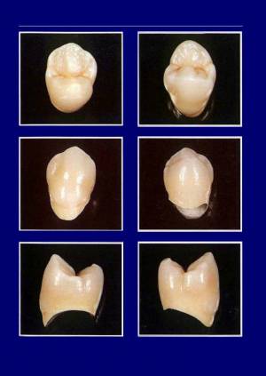 Книга Анатомическая форма жевательной поверхности зубов