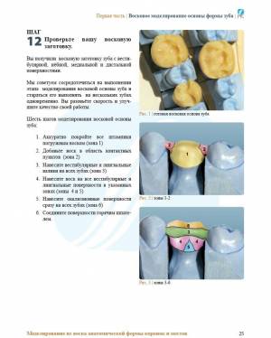 Моделирование из воска анатомической формы боковых зубов