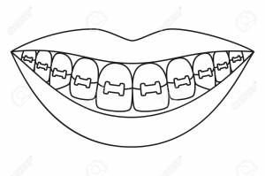 Line Art Black And White Healthy Smile In Braces